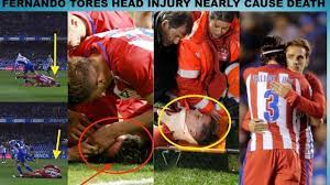 The former liverpool and chelsea ace was knocked out cold. Fernando Torres Horrible Head Injury Deportivo La Coruna Vs Atletico M Deportivo La Coruna Fernando Torres La Coruna