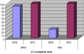 Column Chart Demonstrating The Sen And Spe Of Mra Versus Mri