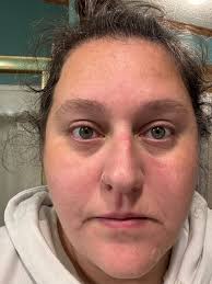 I just feel tired all the time. And I get winded as im walking down the  hallway at work as cna. I was in hospital for fluid