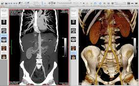 Maybe you would like to learn more about one of these? Open View And Read Dicom Dcm Medical Images In Mac Os X Ios With Osirix Osxdaily