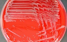 Image result for yersinia fotos