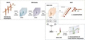 On passing a dropout of 0.3, 30% of the nodes are dropped out randomly from the neural network. A Convolutional Neural Network Approach To Detect Congestive Heart Failure Sciencedirect
