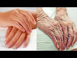 Remove Wrinkles From Hands And Fingers Get A Younger Hands Youtube Wrinkles Hands Home Remedies For Wrinkles Wrinkle Remover
