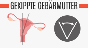 Schmerzen Beim Sexualverkehr Im Bauch 11 Ursachen 2021 Potenz Tipps