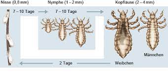 Kopflause Gesundheitsinformation De