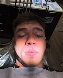 cat scratch fever 🐈‍⬛