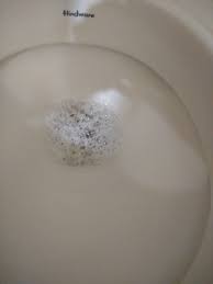 UKidney - Foamy urine.