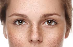 Symptoms of skin pigmentation are quite easy to spot. How To Remove Pigmentation In Singapore Reviews Prices