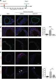 That's why we proudly offer 100% satisfaction guarantee on our residential pest control, cockroach control, scorpion control, termite control, and rodent. Identification Of A Novel Class Of Rip1 Rip3 Dual Inhibitors That Impede Cell Death And Inflammation In Mouse Abdominal Aortic Aneurysm Models Cell Death Disease