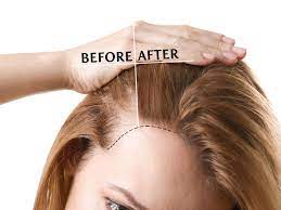 Pura d'or argan oil shampoo and argan oil conditioner is a good hair loss product for women. How To Use Argan Oil For Hair Growth