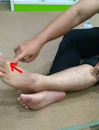 Seperti ditusuk mengapa jari kaki terasa kebas mengapa jari kaki dingin mengapa jari kaki terasa panas mengapa jari kaki sering kram obat untuk keseleo jempol kaki obat terkilir jari kaki berapa lama penyembuhan patah tulang jari kaki kenapa jari kaki terasa ngilu memar di jari kaki jari kaki. Hujung Ibu Jari Kaki Berdenyut