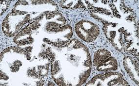 Image result for Antizoma