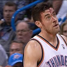 Oklahoma City Thunder are auctioning off a pair of Nick Collison's  blood-stained sneakers