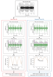 Schematic Processing Flow Chart For Hr And Rr Estimation