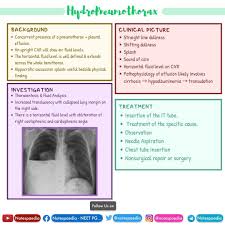 Image result for Succussion Splash