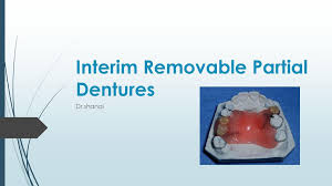 We did not find results for: Interim Removable Partial Dentures Ppt Download
