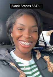 Braces Color for Black Skin