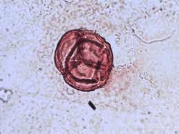 Image result for Eriocoelum