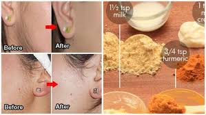 To see which treatments work and which ones don't. How To Get Rid Of Facial Hair Permanently Online Discount Shop For Electronics Apparel Toys Books Games Computers Shoes Jewelry Watches Baby Products Sports Outdoors Office Products Bed Bath