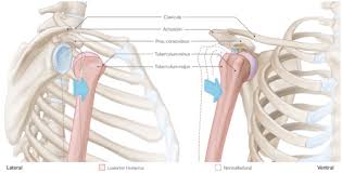 Tag 48 Schultergelenkluxation Flashcards Quizlet
