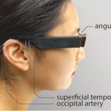 PDF) Glabella: Continuously Sensing Blood Pressure Behavior using an  Unobtrusive Wearable Device