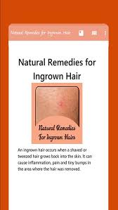 The myth that waxing doesn't cause ingrown hairs stems from the fact that waxing is not actually however, tweezers tend sometimes cutting the hair halfway through instead of removing them all the. Natural Remedies For Ingrown Hair For Android Apk Download