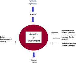 Celiac disease is one of the most common human autoimmune diseases. Genetics And Pathogenesis Of Coeliac Disease Sciencedirect