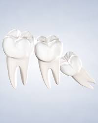 Impacted wisdom teeth can also push on nearby teeth or damage your jawbone.1 x trustworthy source pubmed central journal archive from the u.s. Wisdom Teeth Removal At Oral Surgery Group In Middlesex Nj