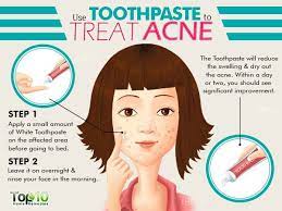 How to get rid of cystic acne overnight home remedy. Home Remedies And Self Care Tips To Manage Acne How To Treat Acne Acne Cure Home Remedies For Acne