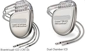 Image result for Internal Cardiac Defibrillator