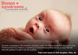 Pin By Nuby Usa On Peace Love Down Syndrome Down Syndrome Awareness Down Syndrome Down Syndrome Kids
