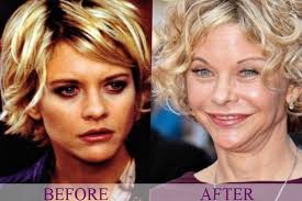Lark voorhies plastic surgery before after no comments | sep 9, 2015. 10 Times Plastic Surgery Went Horribly Wrong For Celebrities