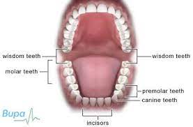 How is a wisdom tooth removed? Wisdom Teeth Removal