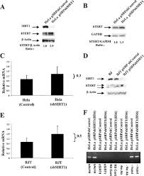 Cu plus în cont activezi oferte, achiți cu cardul de credit sau debit bcr și primești bani înapoi! Sirt1 Acts As A Nutrient Sensitive Growth Suppressor And Its Loss Is Associated With Increased Ampk And Telomerase Activity Molecular Biology Of The Cell