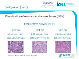 Pertinence Of The Who 2010 Guideline On Nec Diagnosis Reliable Pathology Reporting Of Extra Pulmonary Large Cell Nec Jm Van Der Zwan Ph D Iacr Vancouver Ppt Download