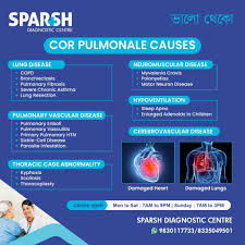 Image result for Cor Pulmonale