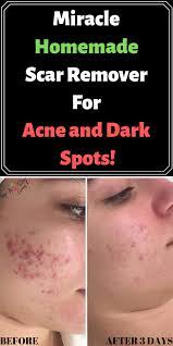 Pin On All About Skin Care