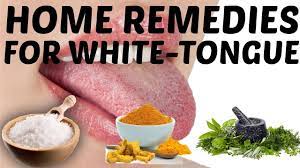 14 Home Remedies For White Tongue And Prevention Tips
