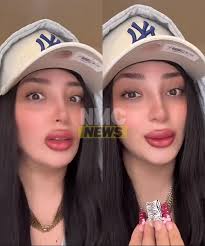 😱 La cantante y licenciada en derecho Bellakath anuncia demanda contra  cirujano por usarla como ejemplo de "malas cirugías"