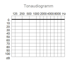 How To Read Your Audiogram At Your Hearing Test