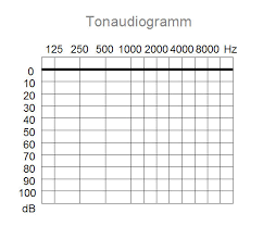 how to read your audiogram at your hearing test