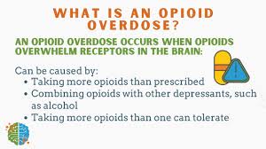 Image result for Opioid Overdose