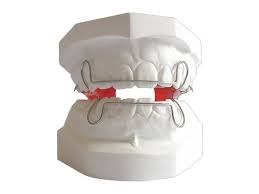 Meyve qurudan aparat almaqla evdə özünüz meyvə quruları hazırlaya bilərsiniz. Katalog Aparatow Ortodontycznych Ortodonta Prudnik