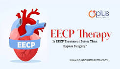 Is EECP Treatment Better Than Bypass Surgery? | OPLUS