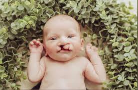 The Story Behind Two Smiles