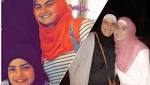 الجمال الصحة حكاية شقيقتين تعانيان