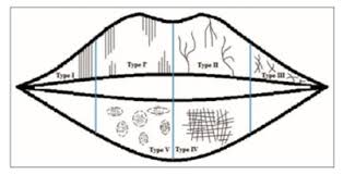 The tape is placed on the skin of the animal, and then whatever sticks to the tape can be examined under microscope. Sex Differentiation By Lip Print Analysis In Malays Lipstick Cellophane Tape Techniques Arc Journal Of Forensic Science