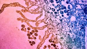Without medication, it may take years before hiv weakens your immune system to the point that you have aids. Antibiotic Molecule Enables Immune System To Kill Hiv Infected Cells