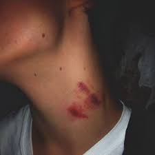 I Love Hickeys It S Like You Re Leaving Your Mark And I Think It S Cute Hickeys Hickey Lovebites Lovebite H Gender Reveal Invitations Hickeys Love Bites