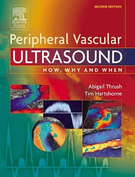 Peripheral Vascular Ultrasound: How, Why and When by Abigail Thrush  BSc(Physics) MSc(Medical Physics) MIPEM (member of the Institute of Physics  and Engineering in Medicine) (2004-10-27): Abigail Thrush: Amazon.com: Books